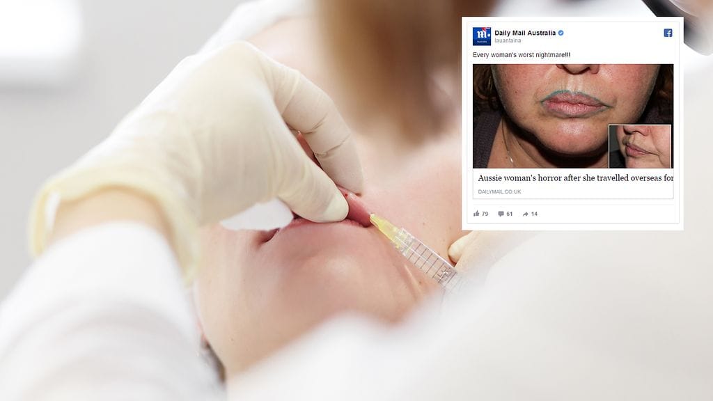 50-vuotiaan Karinen huultenrajaustatuointi ei ollut sellainen kuin piti.