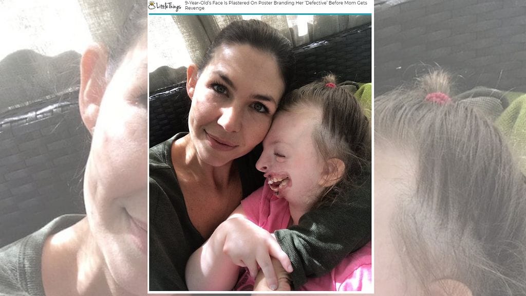 Weaverin Sophie-tyttärellä on harvinainen Rettin oireyhtymä. Kuvan lähde LittleThings.com