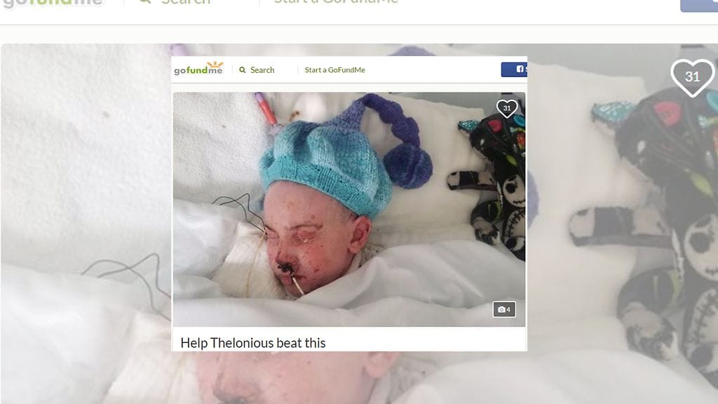 Antibiootti tuhosi Theloinous Zieglschmid-Sylvesterin ihon. Kuvan lähde Gofundme.com