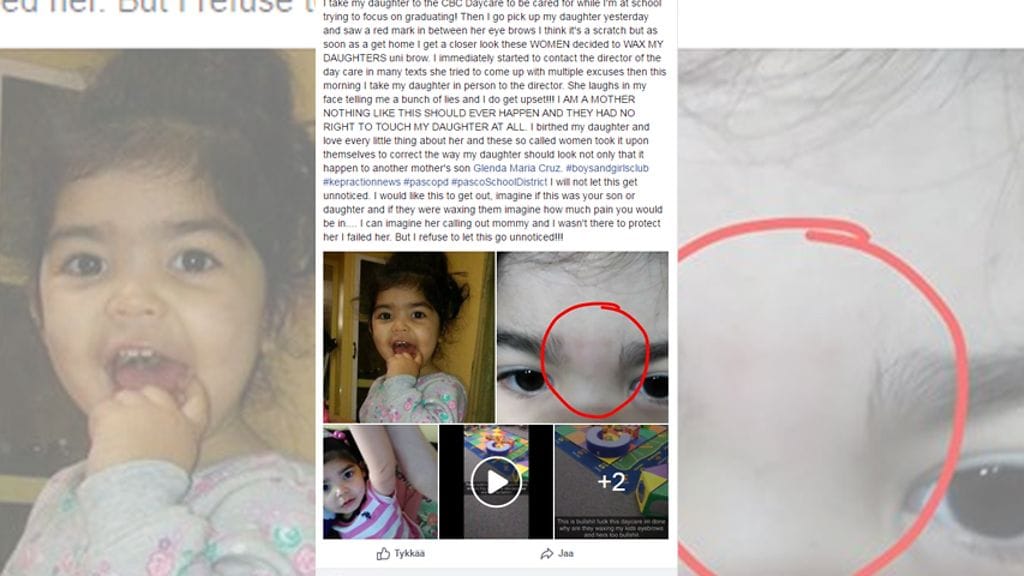 Alyssa Salgado väittää, että hoitopaikka vahautti hänen tyttärensä kulmakarvat. Kuvan lähde Facebook