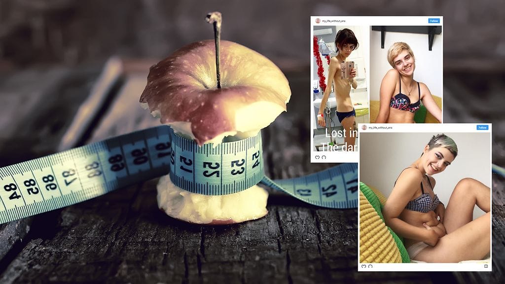 Kymmenet tuhannet ihmiset seuraavat Connien parantumista Instagramissa.