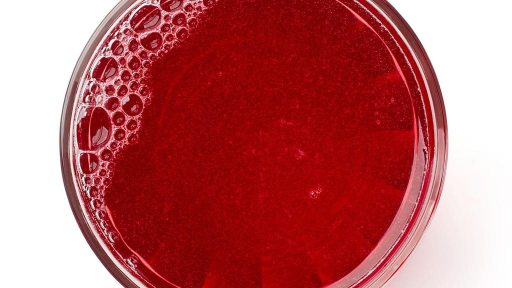 Moni uskoo karpalomehun auttavan virtsatietulehdukseen.