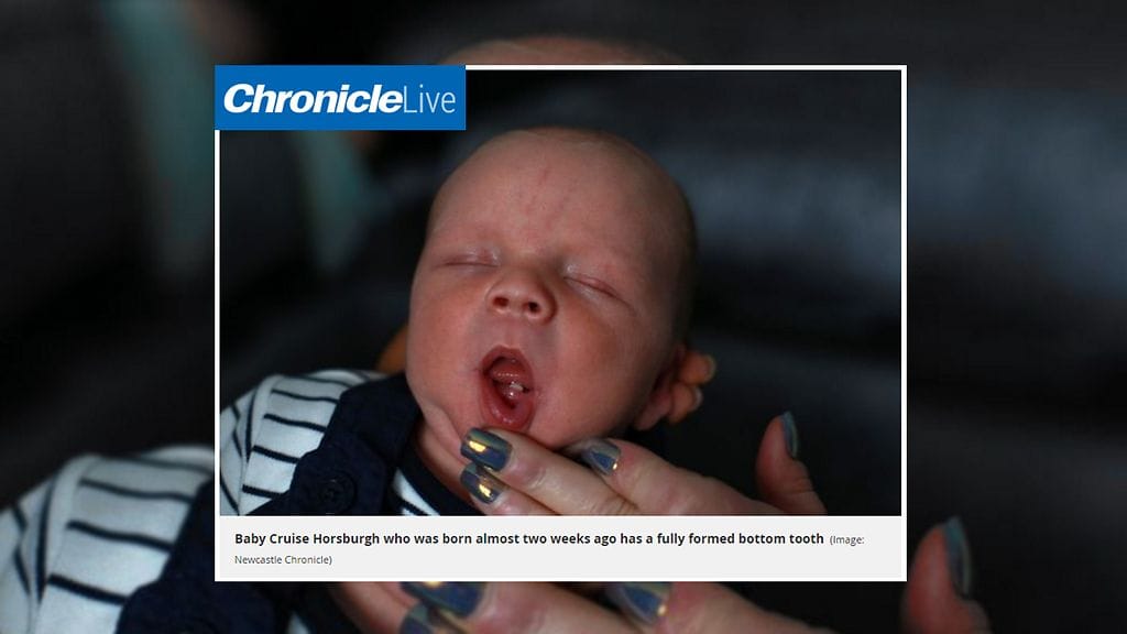 Vauvalla oli syntyessään yksi alahammas.