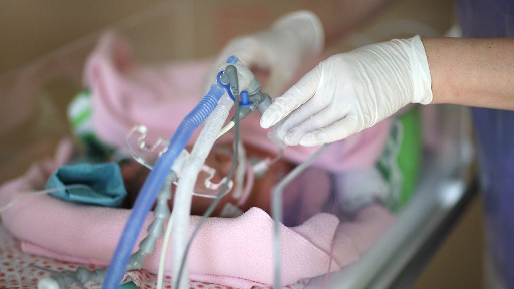 Pieni tyttö on sairaalassa vielä monta kuukautta.