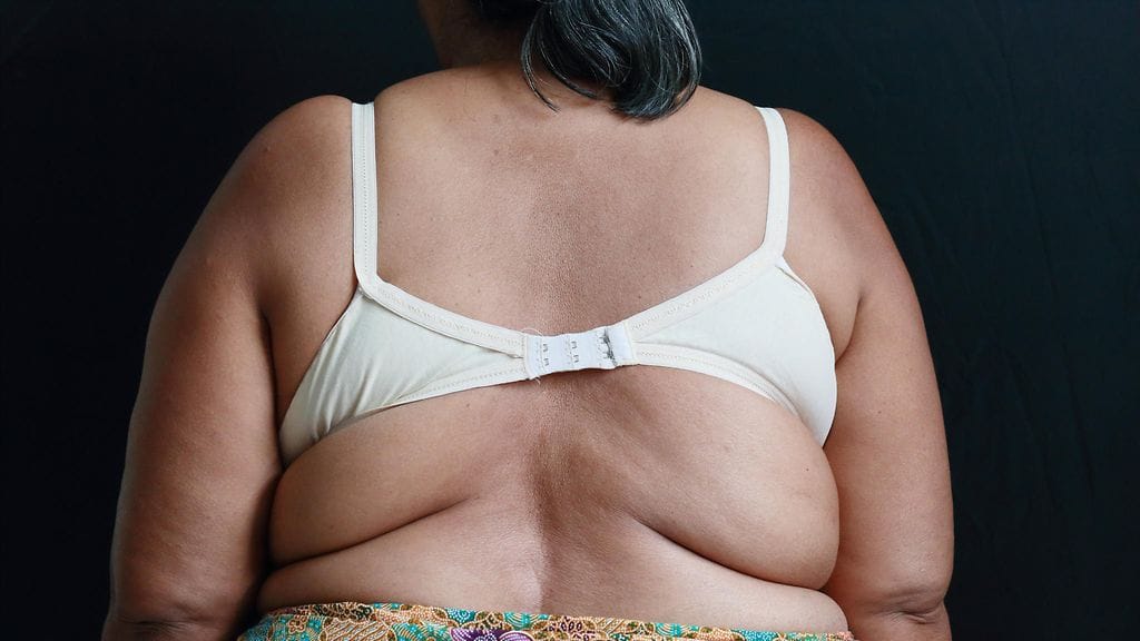 Tutkimuksessa yli puolet 10–15 kiloa laihduttaneista diabeetikoista parantui, yli 15 kiloa karistaneista taas lähes 90 prosenttia. Viidestä kymmeneen kiloa pudottaneistakin parani noin kolmannes. Kuvituskuva.