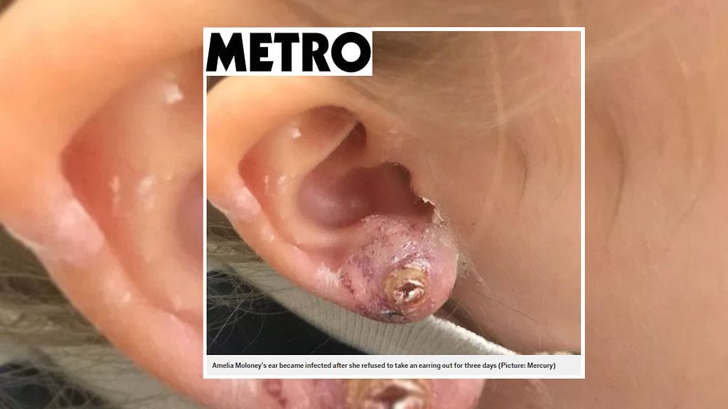 Brittimedia Metro julkaisi karmean kuvan Amerilan korvasta.