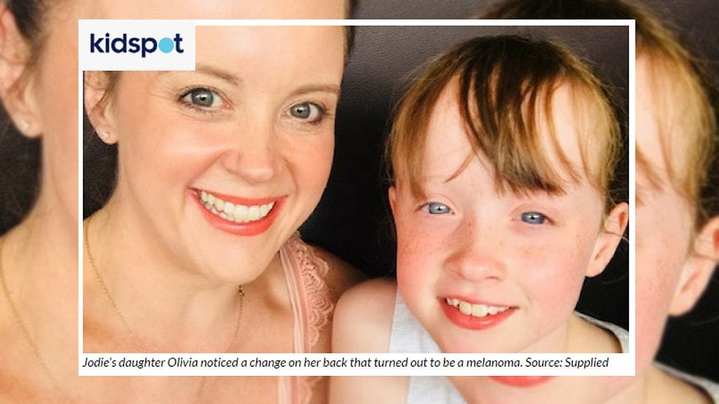 Jodien tytär Olivia huomasi luomen muutoksen ensimmäisenä.