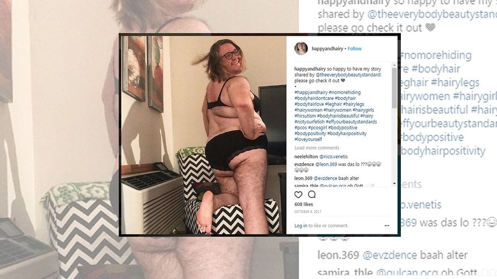 Nyt Jorgensen, 33, kertoo olevansa vapautunut ja voimaantunut. Hän haluaa tarinallaan antaa muille naisille voimaa. Kuvan lähde Instagram