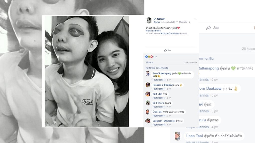 Thaimaalainen Atittaya Chumkeaw ei ole hylännyt vakavasti sairasta rakastaan Kuvan lähde Facebook