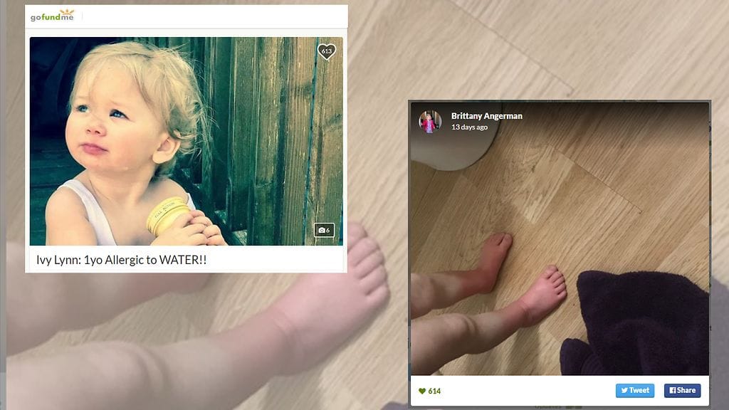 Pieni Ivy on allerginen vedelle.