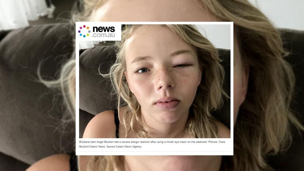 Australialaistyttö sai halvasta silmänaamiosta vakavan allergisen reaktion. Aiheesta uutisoi News.com.au.