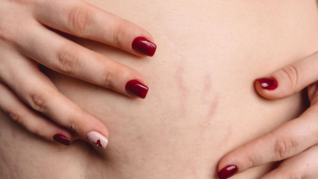 Raskausarvet tuskastuttavat monia.