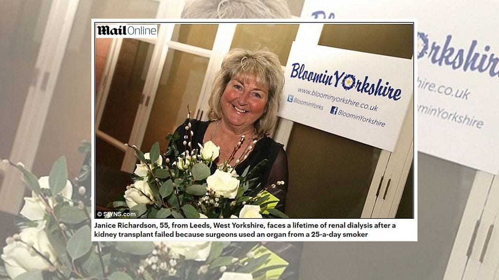 Janice Richardsonia odottaa elinikäinen dialyysi. Kuvan lähde Daily Mail