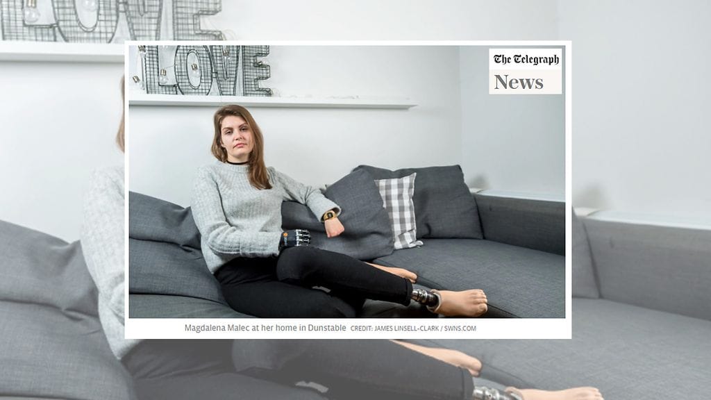 Magdalena Malec, 31, menetti muun muassa molemmat jalkansa. Kuvan lähde Telegraph