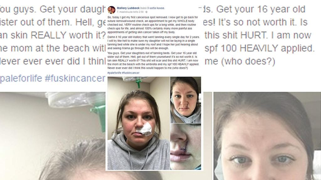 Omaa tytärtään Mallory Lubbock ei aio päästää solariumiin, ja varoittaa myös muita ruskettumisen vaaroista. Kuvan lähde Facebook