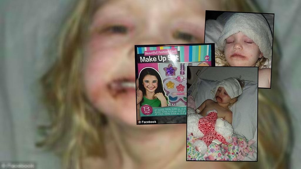 Päivittäistavarakaupan meikit aiheuttivat pahan allergisen reaktion.