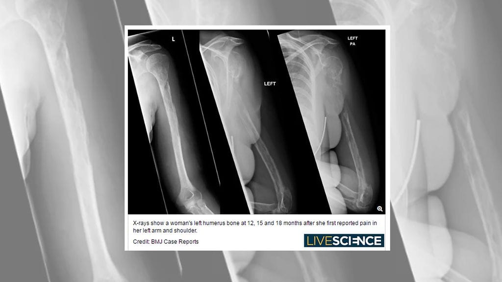 KuvanlähdeLivescience
