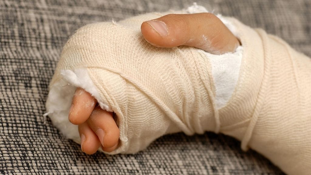 Lapsen käsi kipsattiin, mutta kolmen päivän kuluttua hän alkoi valittaa kovaa kipua käsivarressaan. Kuvituskuva.