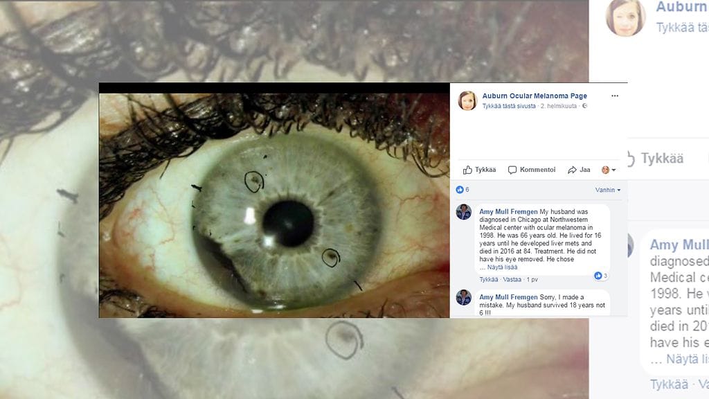Juleigh Greenin sairaus paljastui, kun hän alkoi nähdä outoja valovälähdyksiä. Kuvan lähde Facebook