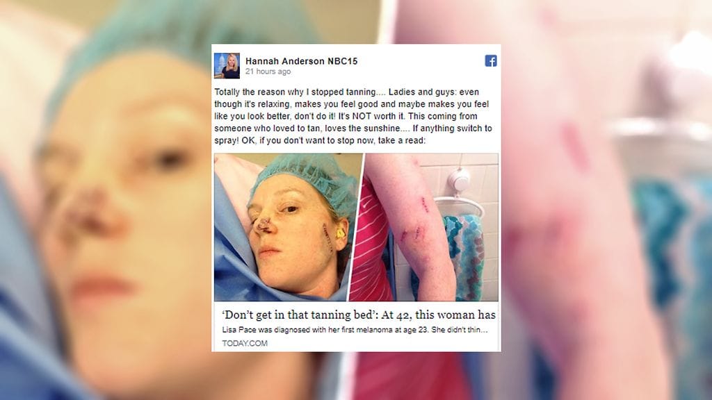 Vasta kasvoihin iskenyt ihosyöpä sai Lisan lopettamaan solariumin.