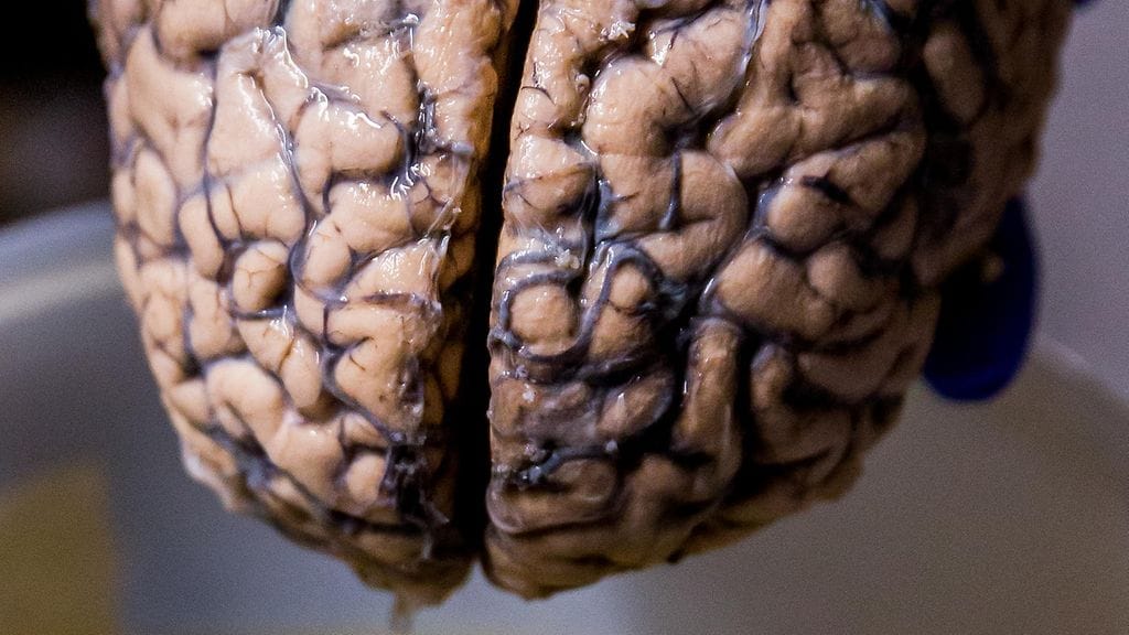 Tutkijat eivät yritä kehittää ajattelevia aivoja, vaan ainoastaan pienen kudosmäärän, josta voitaisiin tehdä päätelmiä ihmisten ja neandertalilaisten eroista.