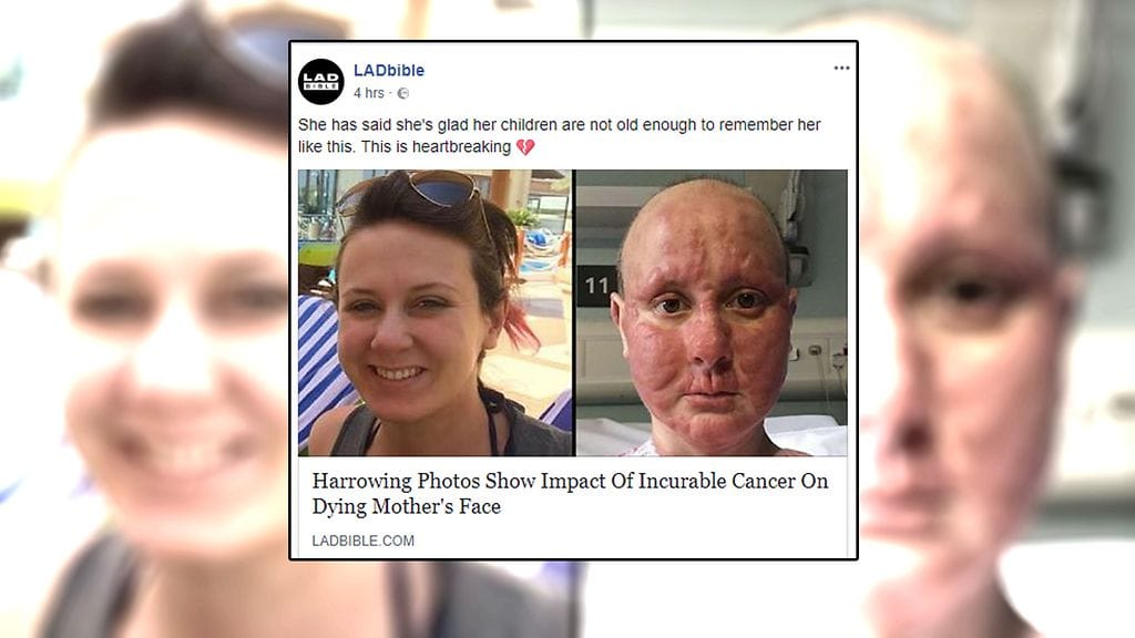 Syöpä on muuttanut nuoren naisen tunnistamattomaksi.