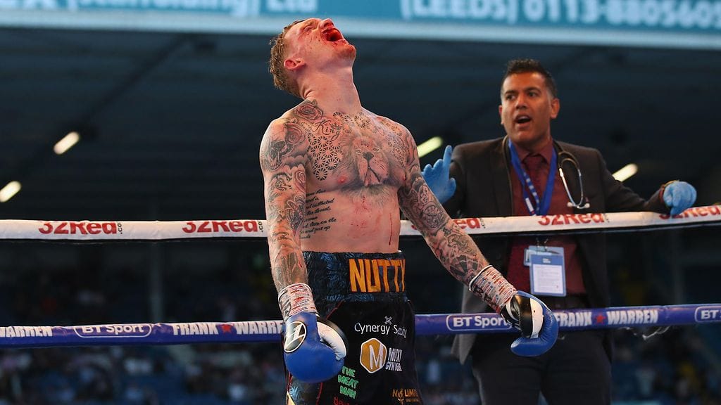 Mason Cartwright reagoi voimakkaasti, kun ottelu keskeytettiin hänen vammojensa takia kesken.