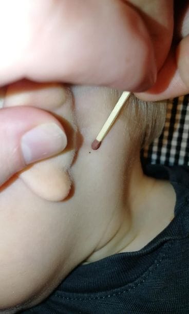 Nymfipunkki korvan takana