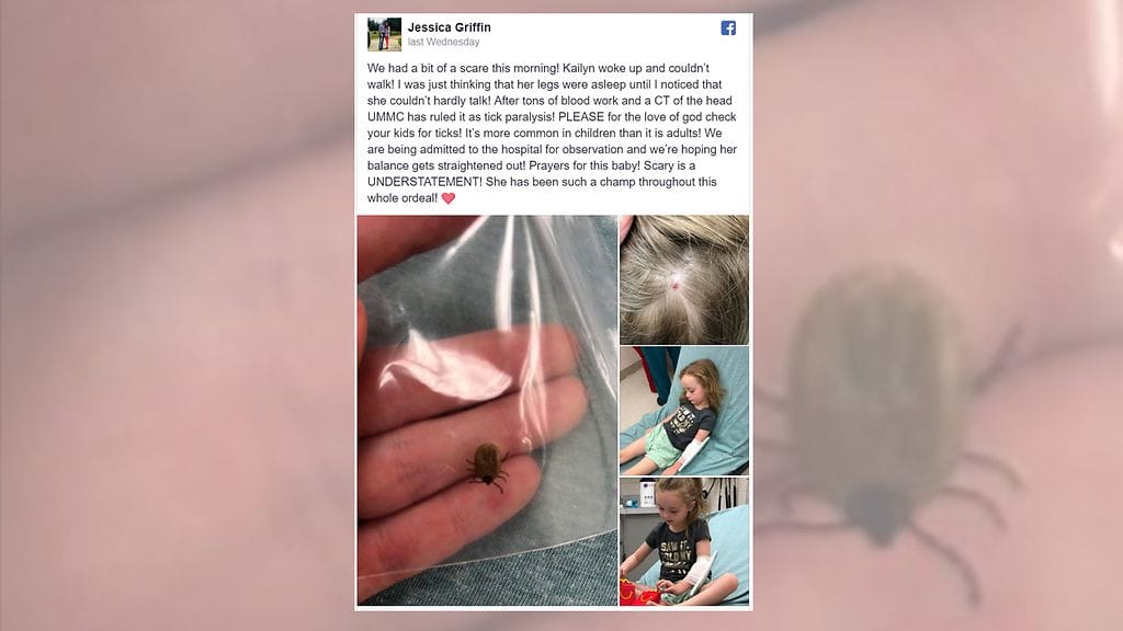 Punkin purema aiheutti pikkutytölle väliaikaisen halvaantumisen.