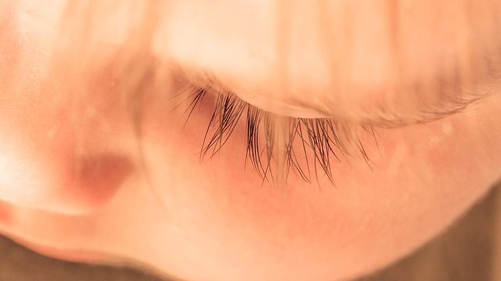 9-vuotias poika sai lääkäristä kurjan diagnoosin: hänen silmästään löytyi laserin aiheuttama, suuri reikä. Kuvituskuva.