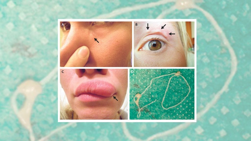 The New England Journal of Medicine