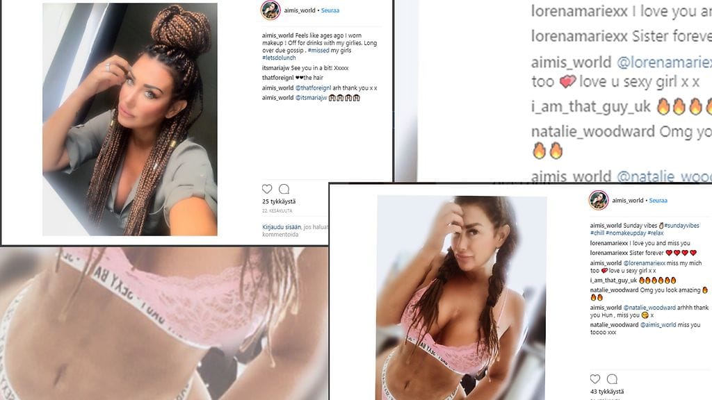 Aimi Veness on käyttänyt jo noin 110 000 euroa kauneusleikkauksiin. Kuvien lähde Instagram