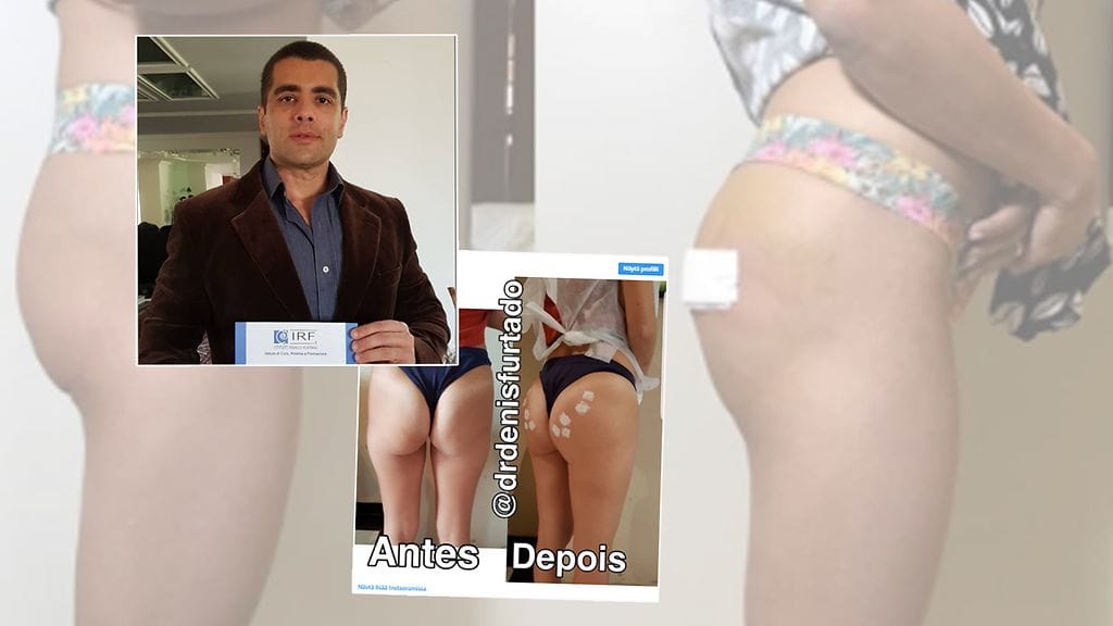 Denis Furtado on jakanut työnsä tuloksia Instagramissa.