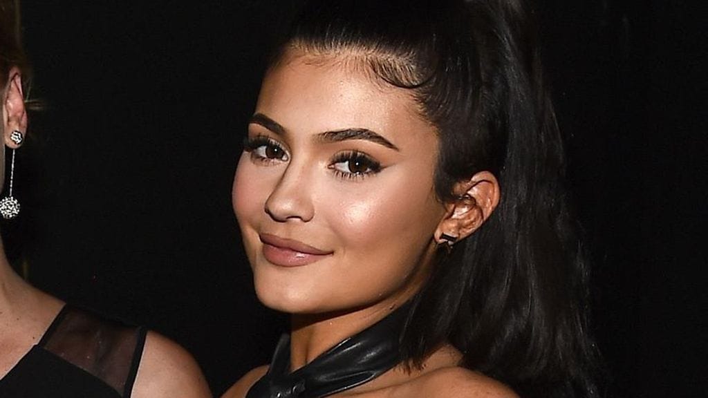 Kylie Jenner on kerännyt kiitosta poistamalla huulitäytteensä.