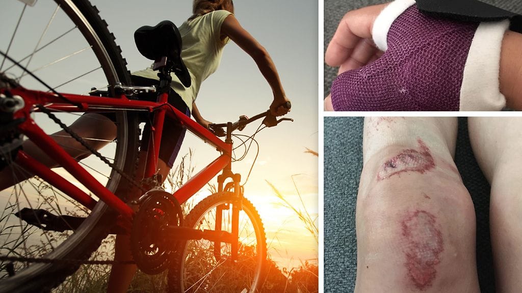 Helena sai pyöräturmassa haavoja, joiden parannuttua käsi pitää vielä leikata.