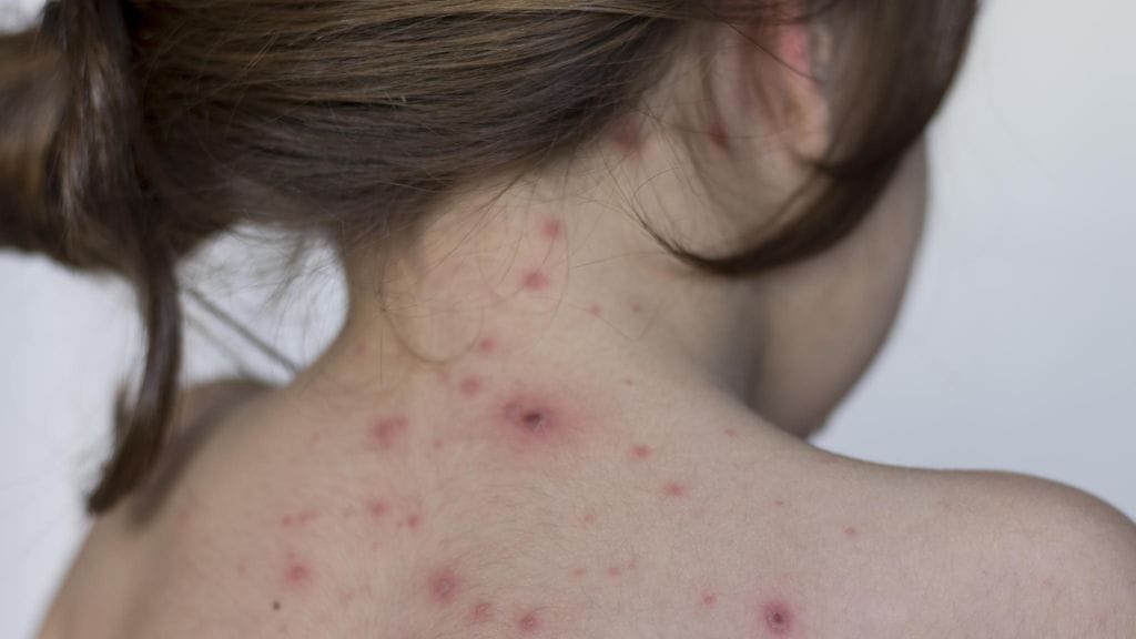 shutterstock_620522405