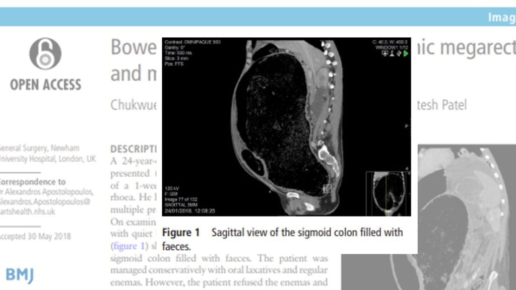 Kuvanlähdecasereports