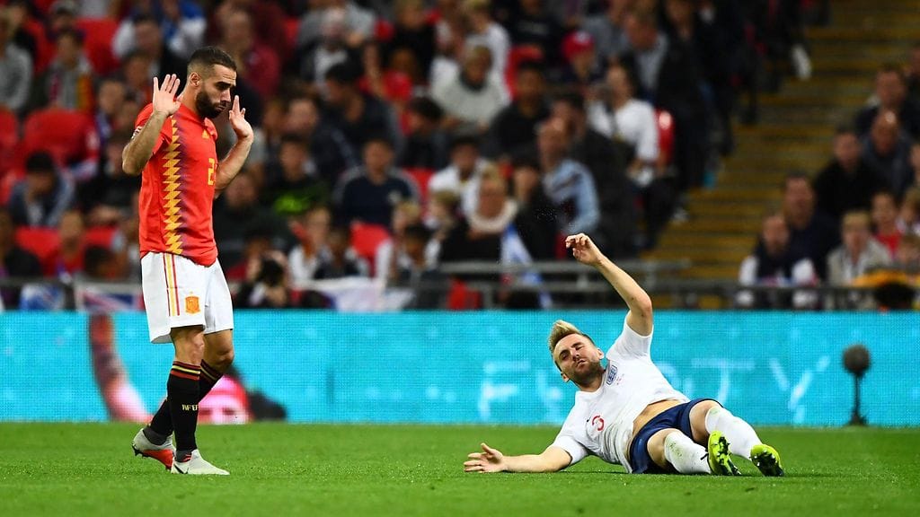 Englannin Luke Shaw loukkaantui ikävässä yhteentörmäyksessä.