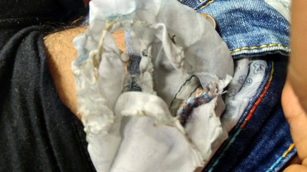 Kännykän akku räjähti taskussa 1