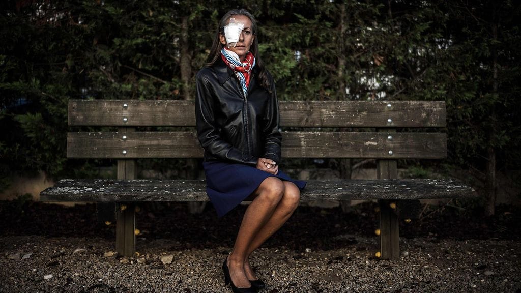 Ranskalainen Corine Remande kuvattuna eilen Lyonissa. Remande sai golfpallon silmäänsä Ryder Cupissa viime perjantaina.