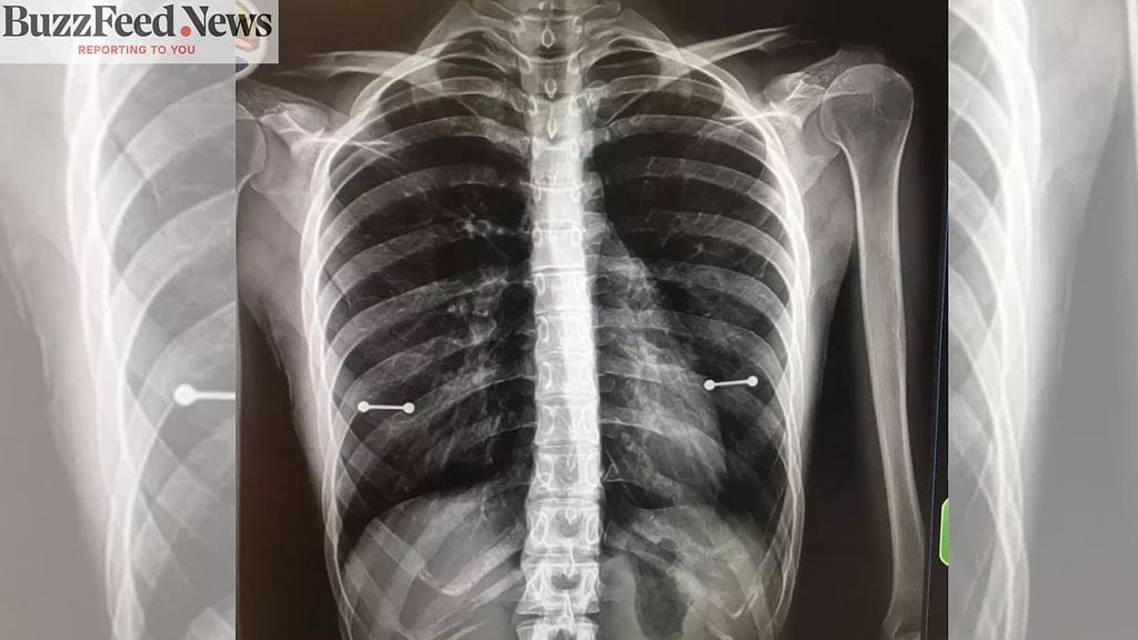 KuvanlähdeBuzzfeednews