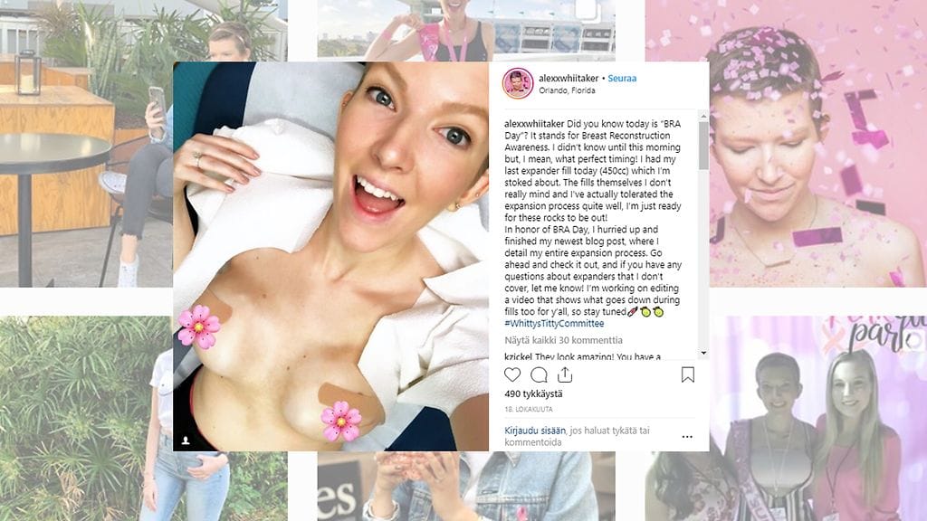 Alexandrian mukaan itseliimautuva alusasu luultavasti pelasti hänen henkensä. Rintaliivien pukeminen johti lopulta syövän löytymiseen. Kuvan lähde Instagram