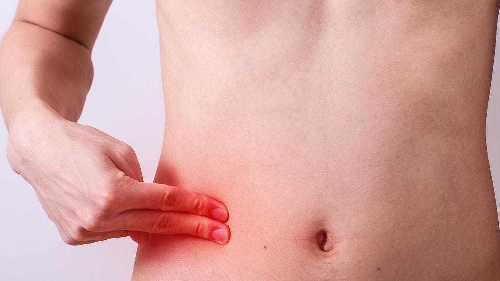 Umpilisäkkeen leikkaus näyttää tutkimuksen perusteella pienentävän riskiä Parkinsonin taudin kehittymiseen. Kuvituskuva.