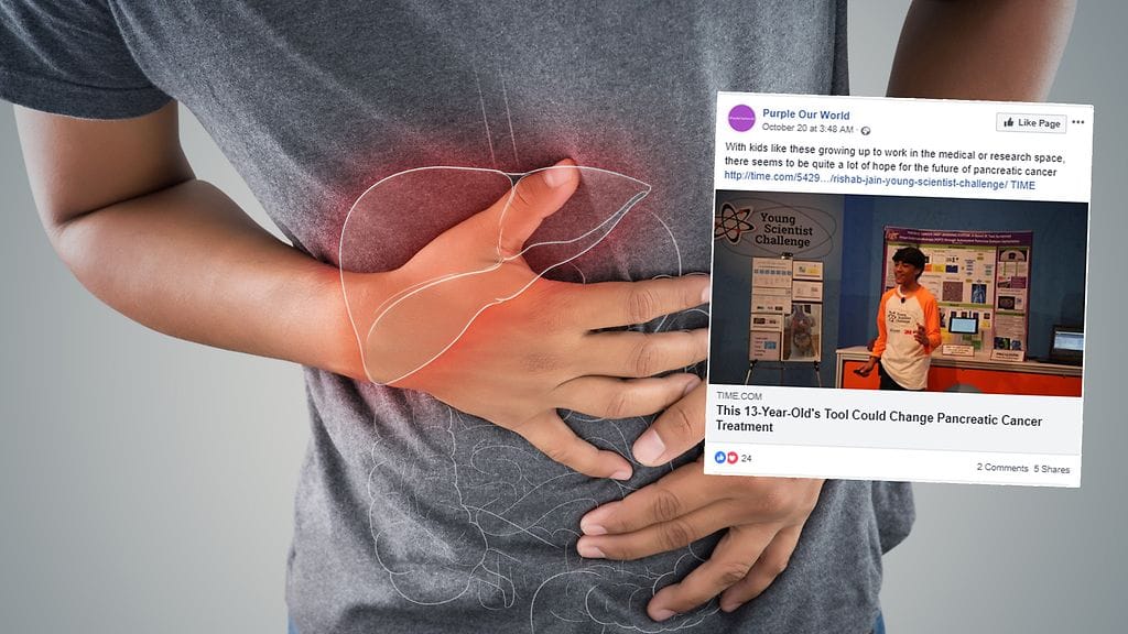 Haiman hankala sijainti vaikeuttaa haimasyövän hoitamista.