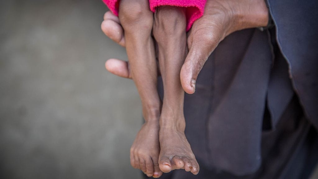 Humanitaarista apua tarvitaan esimerkiksi Etiopiassa, jossa noin kahdeksan miljoonaa ihmistä on vailla ruoka-apua. Kuvituskuva.