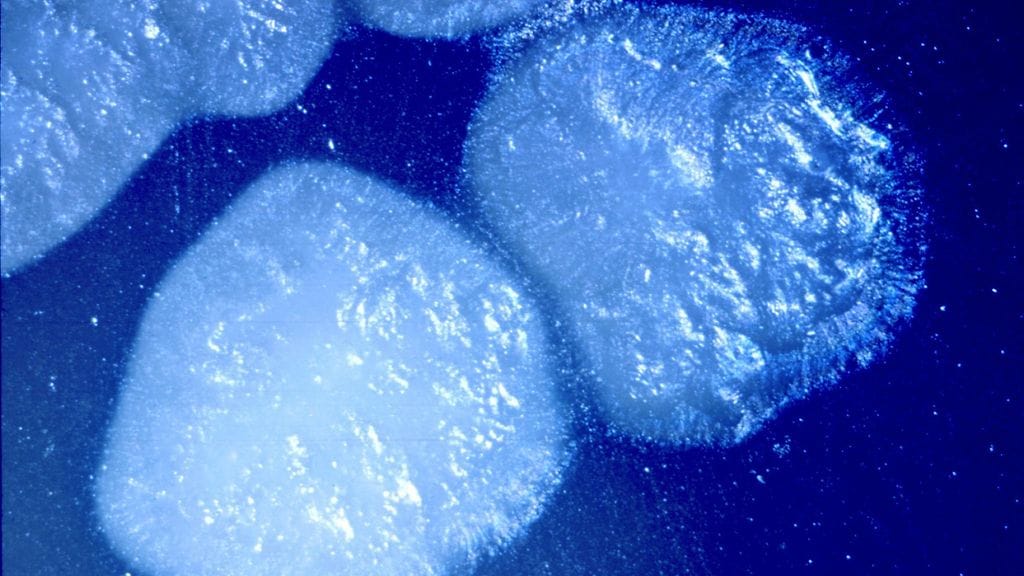 Clostridium botulinum -bakteeri kuvattuna petrimaljalla.