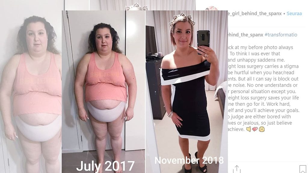 Australialaisäiti päätyi pudottamaan roiman kilomäärän, kun hän melkein menehtyi synnytyksessä. Sandra Abbey painoi tytärtään Laraa synnyttäessään 125 kiloa, kertoo Yahoo. Kuvan lähde Instagram