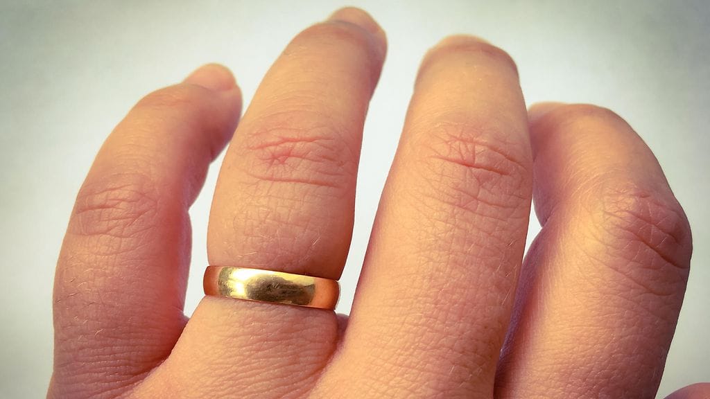 Turvotus syntyy, kun kudoksissa olevien solujen välitilaan kertyy nestettä. Kuvituskuva.