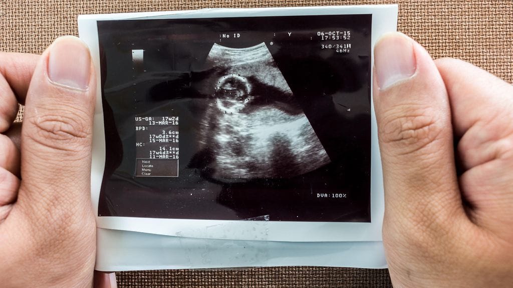 Transsukupuolinen potilas menetti lapsensa ensiavussa sattuneen virhearvion takia. Traagisesta tapauksesta julkaistiin tapausraportti New England Journal of Medicine -julkaisussa.