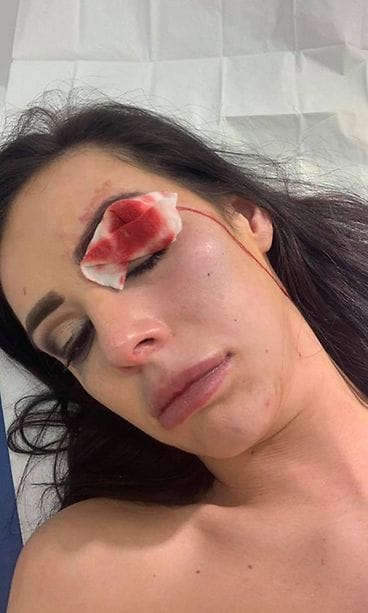 elle stevenson pahoinpitely